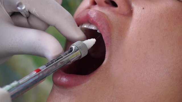 Dental anesthesia injected to female patient