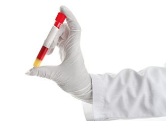 Hand of laboratory assistant holding test tube with blood sample on white background
