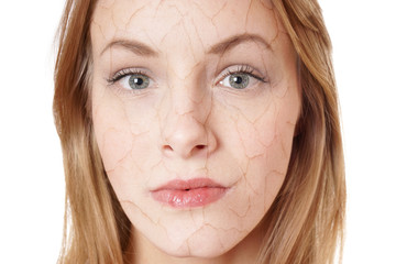 close up portrait of a young woman with dry skin condition