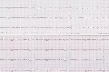 Electrocardiogram paper as medical background 