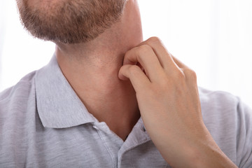 Fototapeta premium Man Scratching His Neck