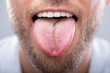 Close-up Of A Man's Tongue