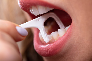 Woman Cleaning Teeth With Dental Floss