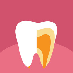 Зуб в разрезе