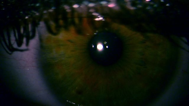 Macro Close-up eye blinking,  Human eye close up macro, eye disease close up, Close up of cornea during eye examination, blepharitis of eye close up