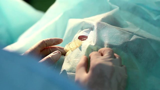 cataract surgery close-up, Surgeon operating eye cataract in hospital surgery, ophthalmology operation, Surgeon's hands in gloves performing laser eye vision correction correction, surgery eye