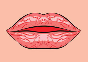 Attractive lips, open mouth graphically illustrated.