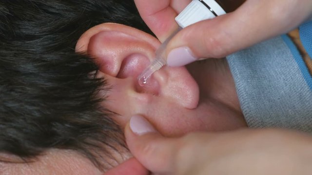 Woman buries drops in a man's ear. Treatment of ear diseases. hands and ear close-up.