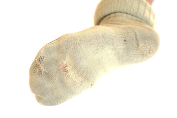 The sock is lacking.