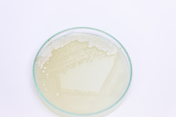 Yeast in petri dish, Microbiology for education in laboratories.