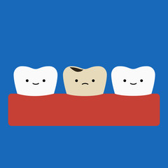 Obraz premium Diente con Caries Tooth Decay 