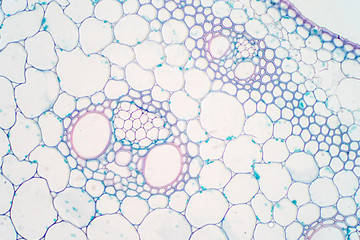 Cross sections of plant stem under microscope view.