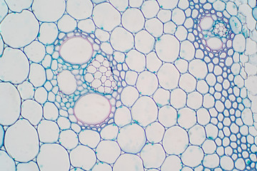 Cross sections of plant stem under microscope view.