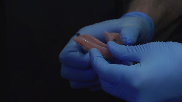 Trimming implant retained dentures for fitting. This is a dental procedure done for a patient who has replaced teeth.