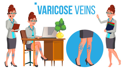 Female Legs In High Heel Shoes With Varicose Veins Vector. Isolated Cartoon Illustration