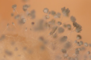 Colony of Characteristics of Fungus (Mold) in culture medium plate from laboratory microbiology.