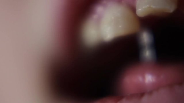 Macro Close Up Of Young Girl Wiggling Loose Front Teeth.
