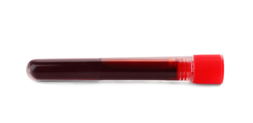 Test tube with blood sample on white background