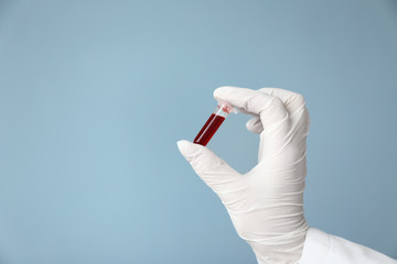 Hand of laboratory assistant holding test tube with blood sample on color background