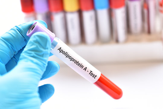 Blood sample tube for apolipoprotein A test
