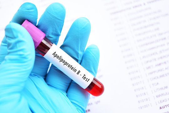 Blood sample tube for apolipoprotein B test
