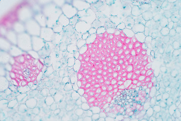 Plant vascular tissue under microscope view.