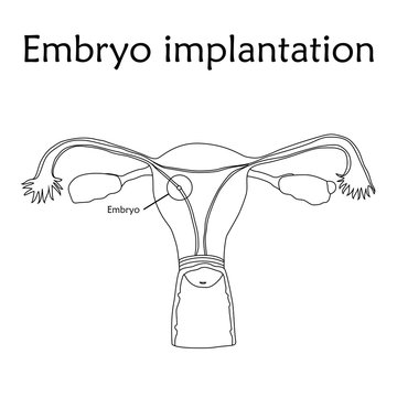 Embryo implantation. The fertilized egg, uterus, womb. Anatomy flat thin line illustration. White background.