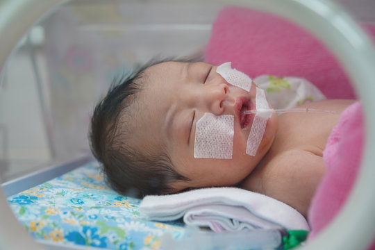 Newborn Baby Having The The Breathing Problem After Birth. And The Digestive System Is Not In Normal Condition. Newborn In NICU,Neonatal Intensive Care Unit.