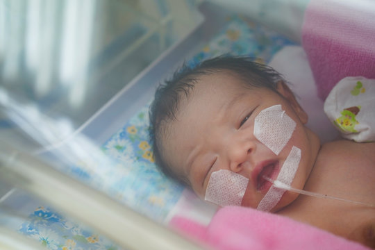 Newborn Baby Having The The Breathing Problem After Birth. And The Digestive System Is Not In Normal Condition. Newborn In NICU,Neonatal Intensive Care Unit.