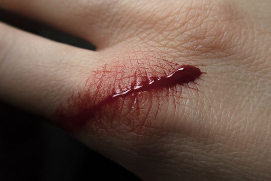 cut on skin