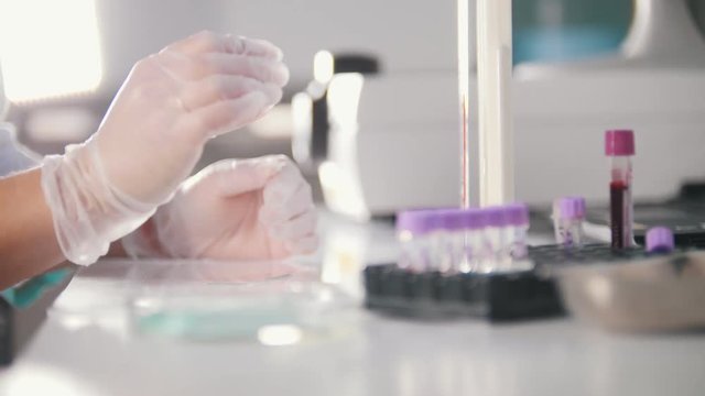 Medical clinic. A blood test. A nurse holds a collected blood in the vitro