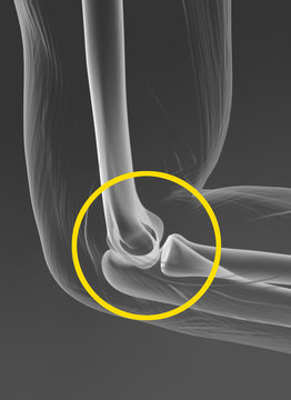 Elbow joint, medically illustration