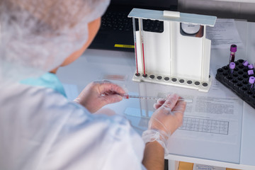 Medical clinic. Nurse at her workplace. Filling up the pipette with blood.