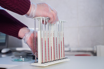 Medical clinic. A stand with pipettes filled with blood. A nurse taking it