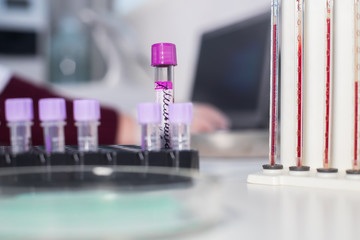 Medical clinic. A stand with pipettes filled with blood standing near the sample tubes. Tube close up