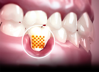 Bocca, denti, gengive. Denti sensibili, ritiro della gengiva. Sensibilità dentale. Laboratorio dentistico. 3d rendering © Naeblys