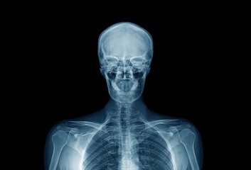 upper part of human body, hight quality x-ray image of human in blue tone