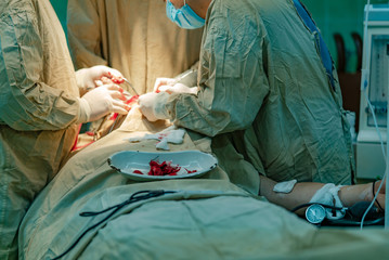 A group of surgeons in special uniform and white gloves with blood perform surgery in the operating...