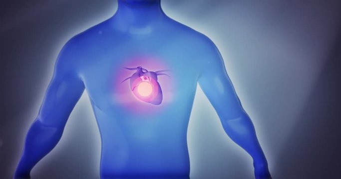 3D anatomy man suffering from heart attack, coronary artery disease, atherosclerosis, myocardial infarction, angina, stroke and chest pain on a dramatic background. Video a great for medical purposes.
