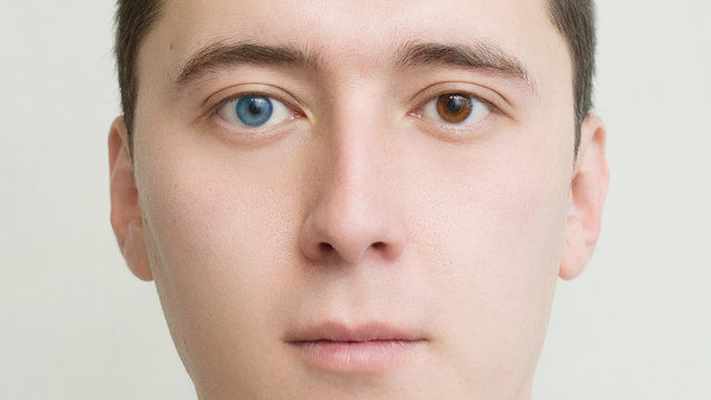 Young man with heterochromia - two different colored eyes. Contact lenses.face close-up 