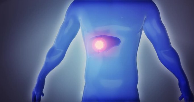 3D anatomy man suffering from toxic liver disease, infection, pain hepatic, alcohol overconsumption, diabetes, cancer, obesity and cirrhosis on a dramatic background. Video a great for medical purpose