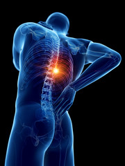 3d rendered medically accurate illustration of a man having a painful back