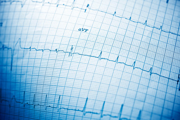 Electrocardiogram close up