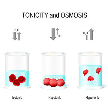 Isotonic, Hypotonic and Hypertonic solutions effects on animal cells.