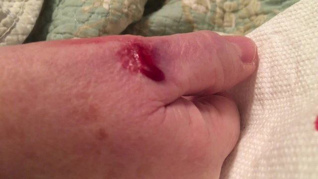 Cut on hand bleeds into pool of blood before eventually dripping downwards at end of clip. 