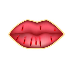 Cracks in the lips. Dry chapped lips. Infographics. Vector illustration on isolated background.