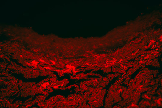 tuberculoid granuloma of hunman