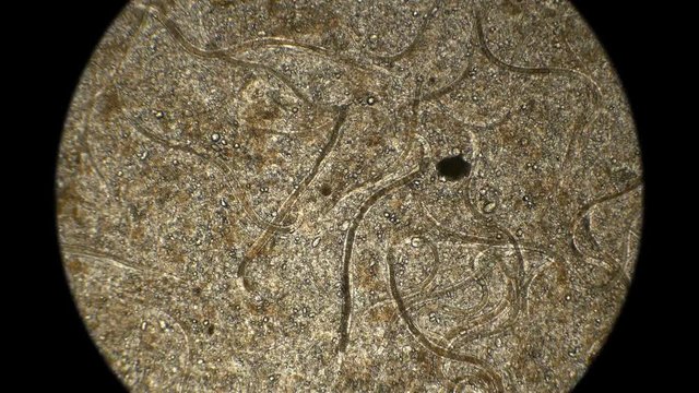 nematode worm colony, which is used to feed fish fry, under a microscope 4K