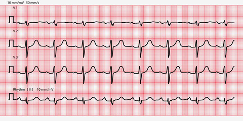Electrocardiogram paper texture, millimeter paper texture. Vector illustration.