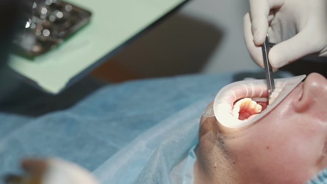 Dentist's hand, holding moment key tool